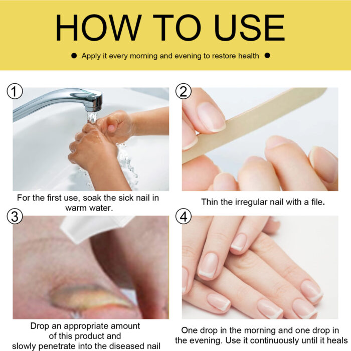 Ginseng Nail Essential Oil Grey Nail Thickening Nail Repair Brightening Nail Removing Soft Nail Moisturizing Essence - Image 7