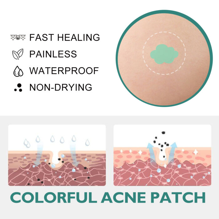 Colorful Acne Patch, Repair Pit Acne Print Smooth Skin Lightening Spot Clear Acne Facial - Image 4