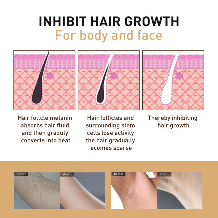 Hair Removal Spray, Mild Non-Irritating Dry And Cool Whole Body Hair Removal And Hair Suppression Spray - Image 4