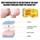 Cracked Skin Banana Repair Cream, Nourishing And Moisturizing Foot Repair Cream To Soften Exfoliation And Remove Dead Skin Calluses