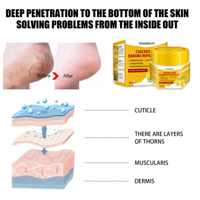Cracked Skin Banana Repair Cream, Nourishing And Moisturizing Foot Repair Cream To Soften Exfoliation And Remove Dead Skin Calluses - Image 5
