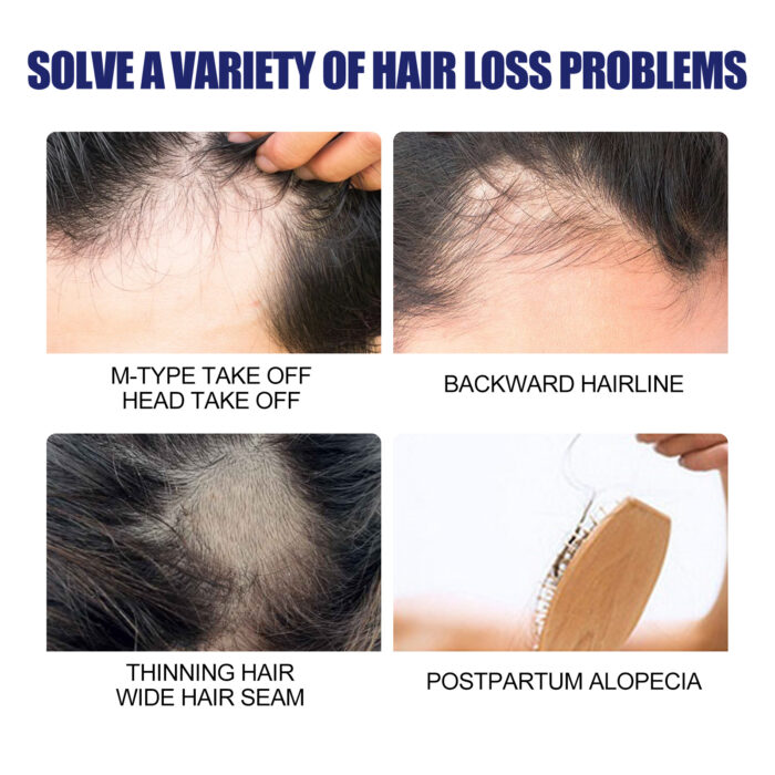 Men's Dense Hair Foam Machine, Repair Hair Root Follicle Men's Hair Thick Moisturizing Foam - Image 4
