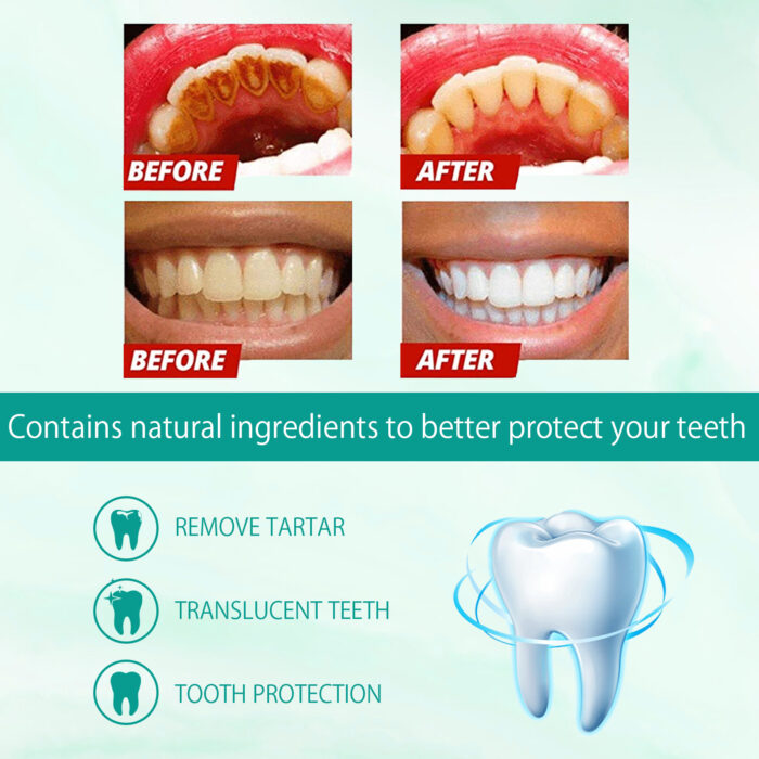 Foam Toothpaste Breath Freshening Whitening Toothpaste Tooth Anti-Moth Mouth Cleaning Tooth Stains And Gum Care - Image 4