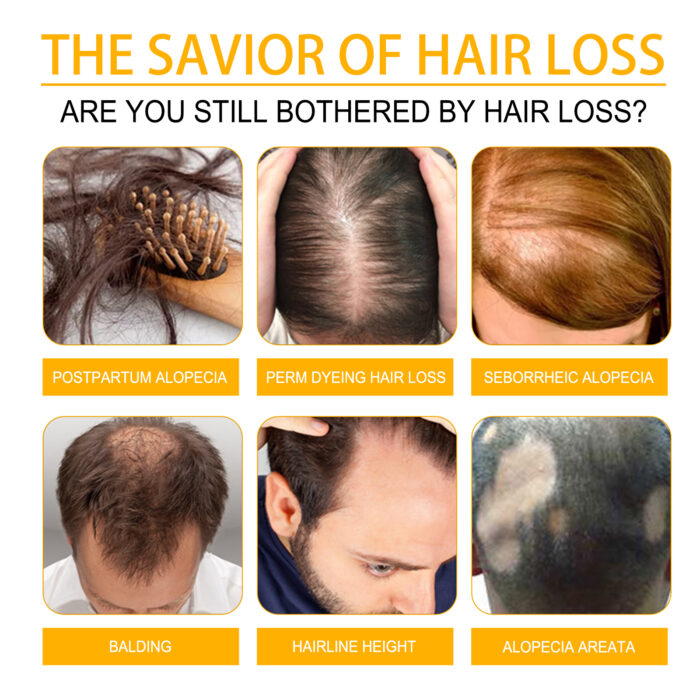 Hair Care Essential Oil Moisturizes, Nourishes, Softens And Brightens Hair Care Oil - Image 5
