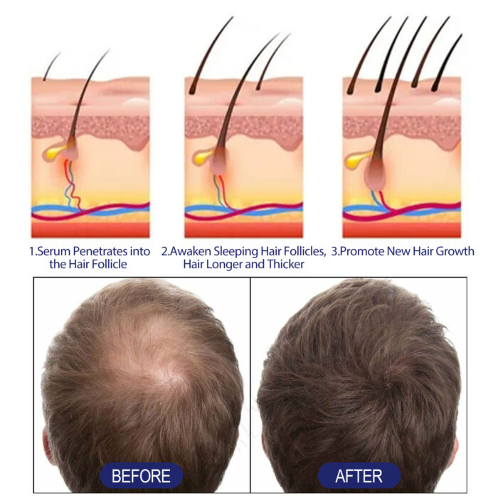 Men's Dense Hair Foam Machine, Repair Hair Root Follicle Men's Hair Thick Moisturizing Foam - Image 5