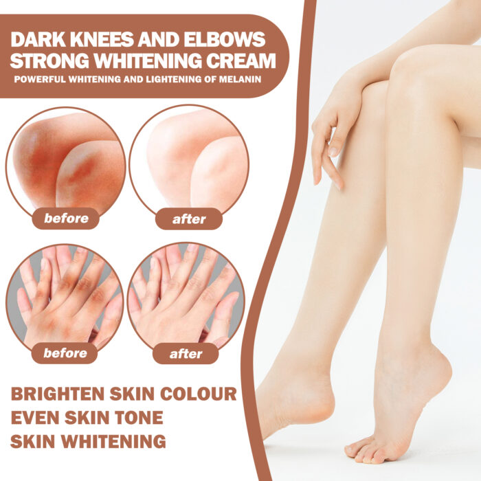 Joint Whitening Cream, Moisturizes Dull Skin Whitening Repair Cream For Joints And Elbows - Image 5