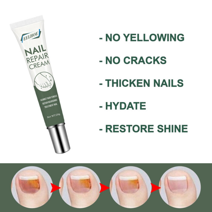 Foot Care And Thickening Nail Repair Cream. Nail Repair Cream - Image 5
