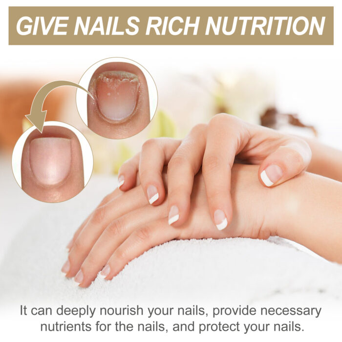 Nail Care Cream Repair Grey Nail Nail Shine Soft Nail Moisturizing Moisturizing Cleansing And Exfoliating Care Cream - Image 5