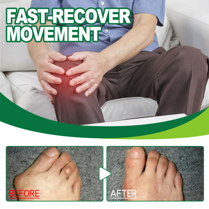 Bee Venom Joint Repair Cream, Relieves Sore Joints Hands And Feet, Shoulders Neck And Lumbar Muscles Body Care Cream - Image 4