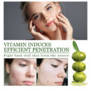 Olive Acne-Clearing Essence, Lightening Acne Mark Removing Closed Mouth Acne Dark Skin Repair Essence