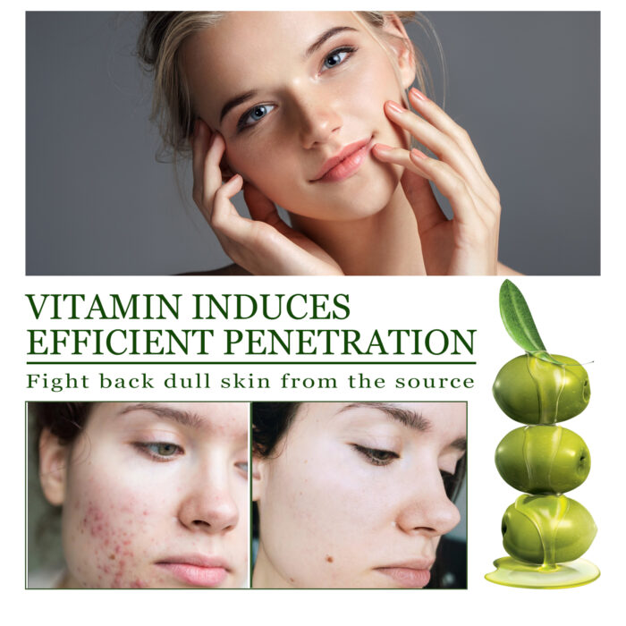 Olive Acne-Clearing Essence, Lightening Acne Mark Removing Closed Mouth Acne Dark Skin Repair Essence - Image 4
