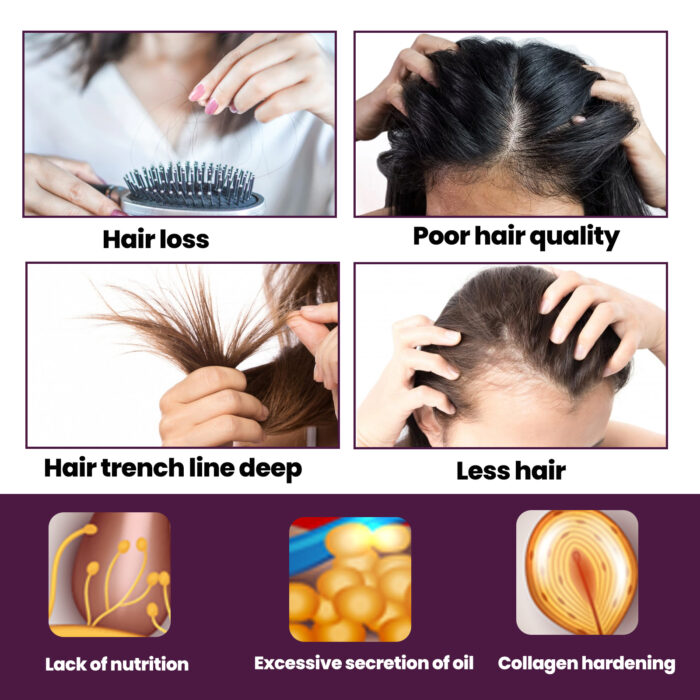 Hair Nutrition Growth Foam, Nutrition Strengthens Hair, Prevents Hair Loss And Irritates Hair Follicles - Image 5