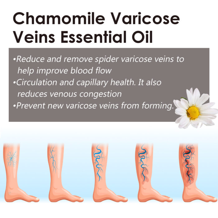 Chamomile Leg Essential Oil Protects Leg Skin And Relieves Leg Discomfort With Daily Massage Essential Oil - Image 4
