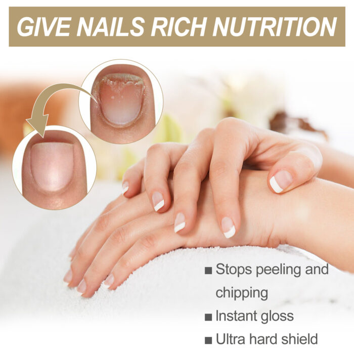 Herbal Nail Nourishing Essence, Hand And Foot Moisturizing Care And Repair Thickening Nail Grey Nail Inlaid Nail Shine Essential Oil - Image 4