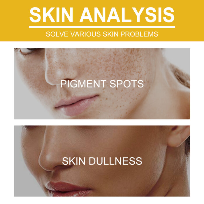V7 Whitening Cream Reduces Wrinkles And Fine Lines On The Face, Moisturizes And Brightens Skin, Anti-Aging And Replenishing Cream - Image 4