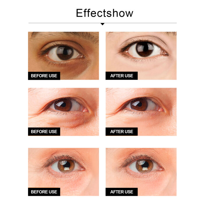 Snake Venom Eye Cream, Firming Eye Bags Hydrating And Reducing Fine Lines Eye Care Eye Cream - Image 5
