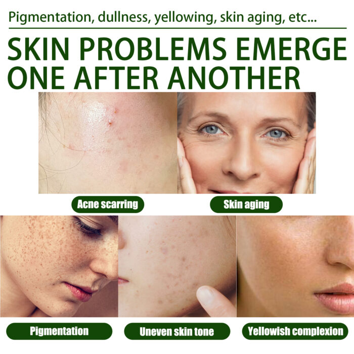 Olive Acne-Clearing Essence, Lightening Acne Mark Removing Closed Mouth Acne Dark Skin Repair Essence - Image 5