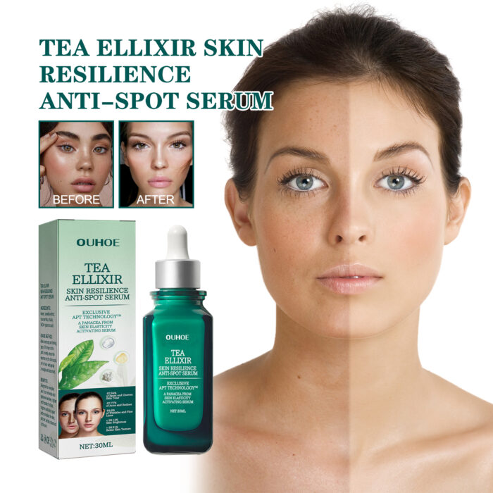 Brightening Blemish Essence, Lightening Melasma Blemish Hydrating And Brightening Skin Essence - Image 3