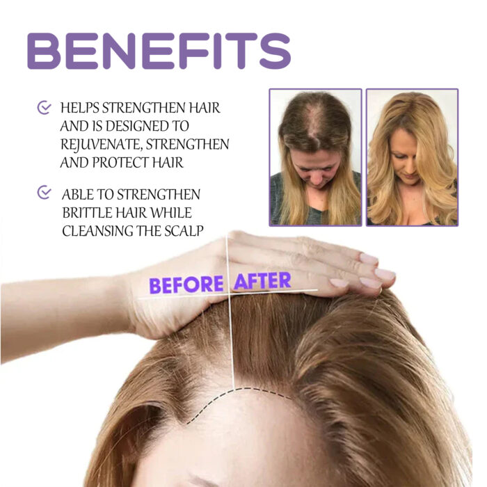Hair Follicle Dense Hair Drops Repair Hair Follicle Nourishing Hair Roots Dense Solid Hair Care - Image 5