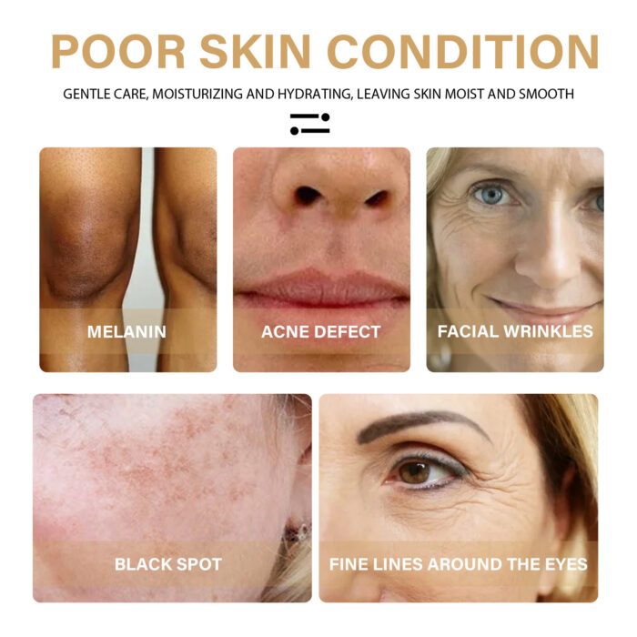 Turmeric Correction Essence Facial Care Hydrating Moisturizing Gentle Moisturizing Skin Care Essence - Image 4