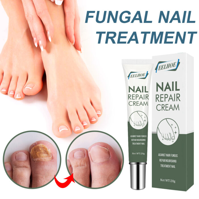Foot Care And Thickening Nail Repair Cream. Nail Repair Cream - Image 3