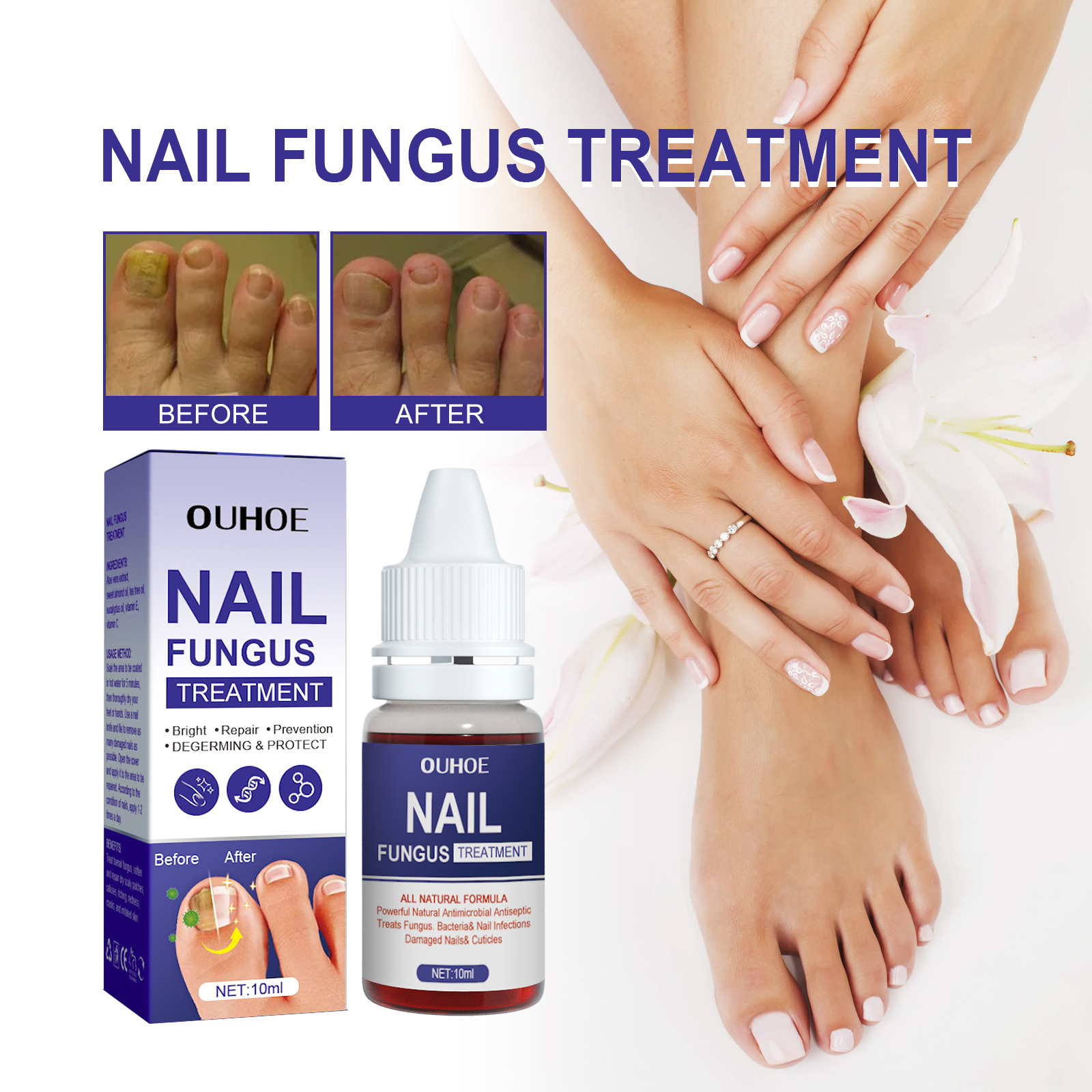 Nail Repair Lotion, Repair Thickening Nail Inlay Gray Nail Shine Soft Nail Care Solution