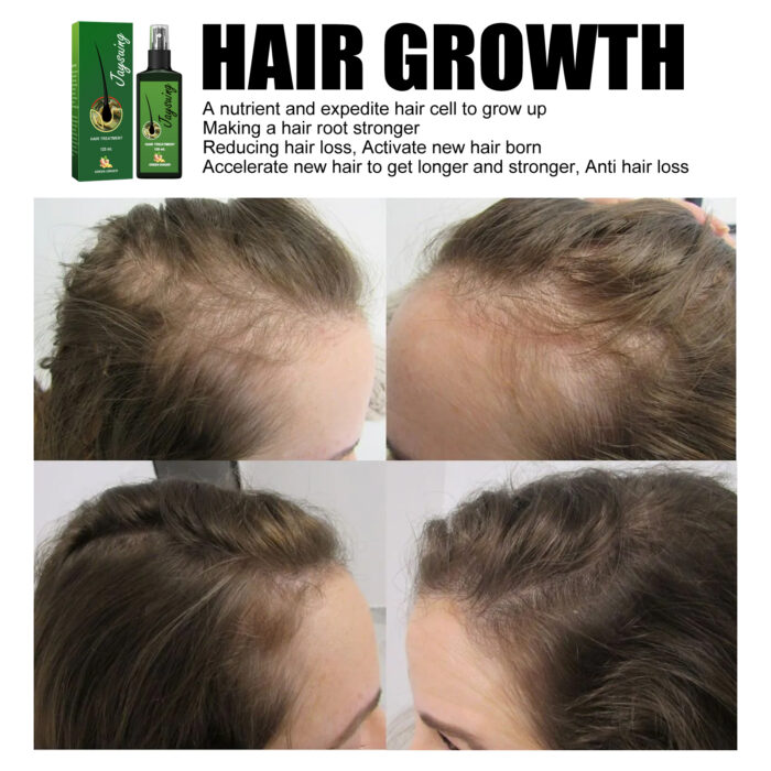 Hair Care Solution Gently Nourishes And Massages Scalp, Moisturizes And Softens Hair Care Spray - Image 4