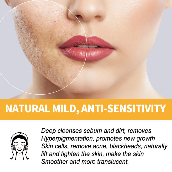 Honey Peel Mask, Tightens Pores Brightens Darkens Skin And Gently Removes Blackheads Apply Facial Mask - Image 5