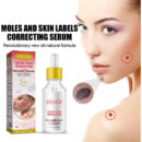Wart Essence Removes Dark Moles Flesh Moles Repair Skin Neck Flesh Grains Flat Especially Corns Remove Warts