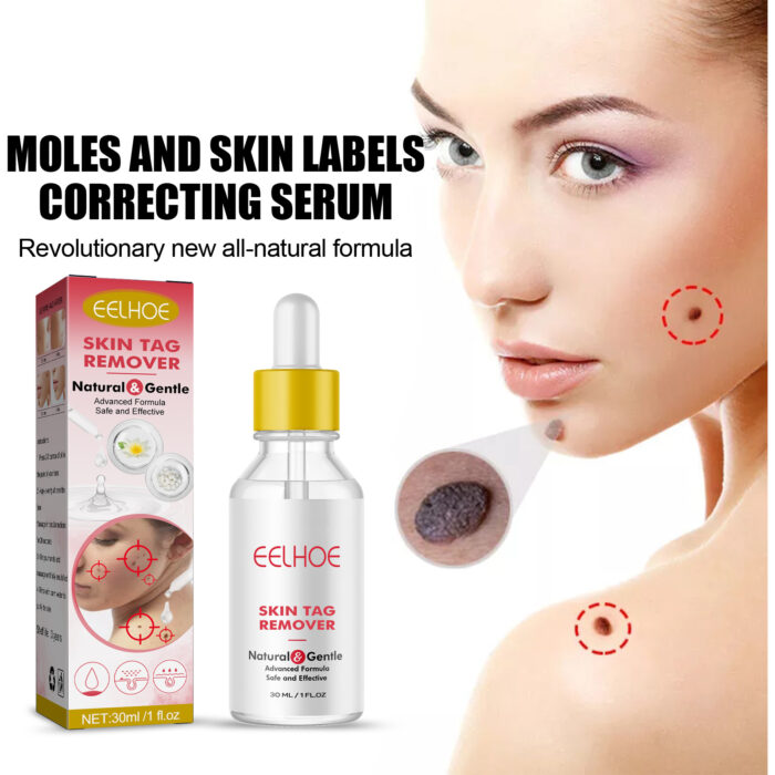 Wart Essence Removes Dark Moles Flesh Moles Repair Skin Neck Flesh Grains Flat Especially Corns Remove Warts - Image 5
