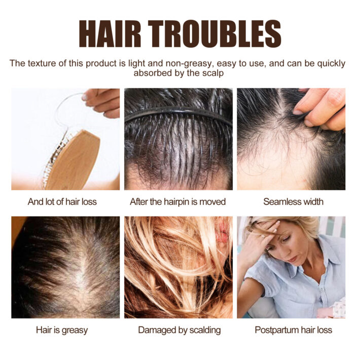 Hair Enrichment Essence, Moisturizes Hair Repair Hair Root Thickening Hairline Strengthening Hair Treatment Essence - Image 5