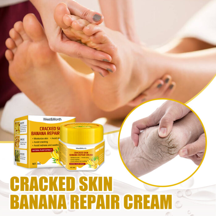 Cracked Skin Banana Repair Cream, Nourishing And Moisturizing Foot Repair Cream To Soften Exfoliation And Remove Dead Skin Calluses - Image 3