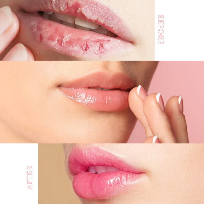 Lip Sleeping Mask, Moisturizing Gently Exfoliating Dead Skin Plump Smooth Lip Mask - Image 6