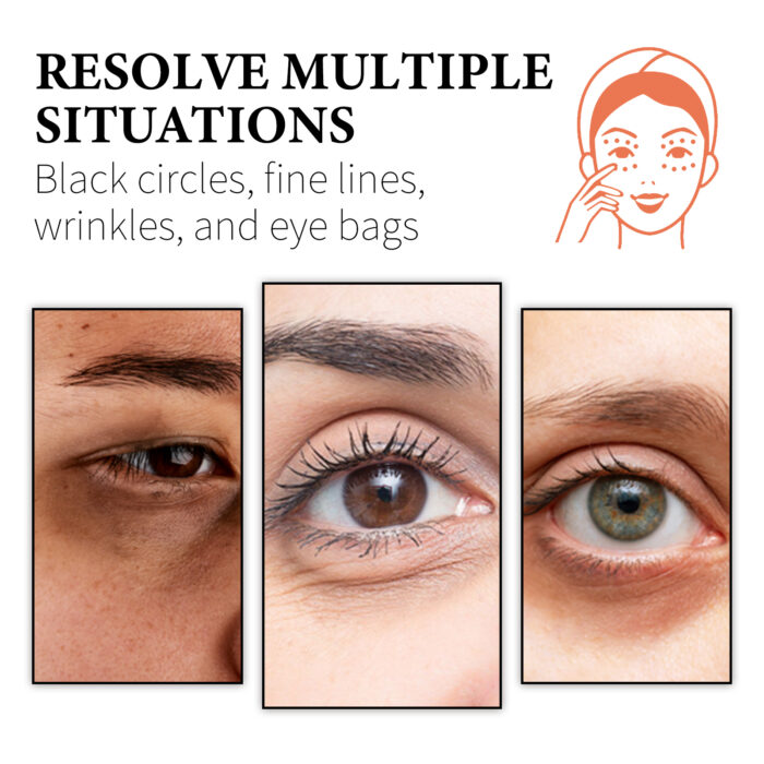 WIYUN Retinol & Collagen Moisturizer Eye Cream, Lightening Dark Circles And Bags Under Eyes Moisturizing Firming Care Multi-Effect Eye Cream - Image 4