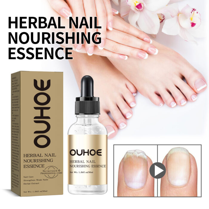 Herbal Nail Nourishing Essence, Hand And Foot Moisturizing Care And Repair Thickening Nail Grey Nail Inlaid Nail Shine Essential Oil - Image 3