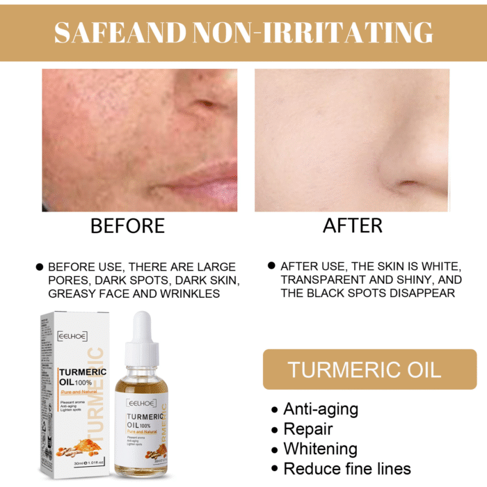Turmeric Correction Essence Facial Care Hydrating Moisturizing Gentle Moisturizing Skin Care Essence - Image 5