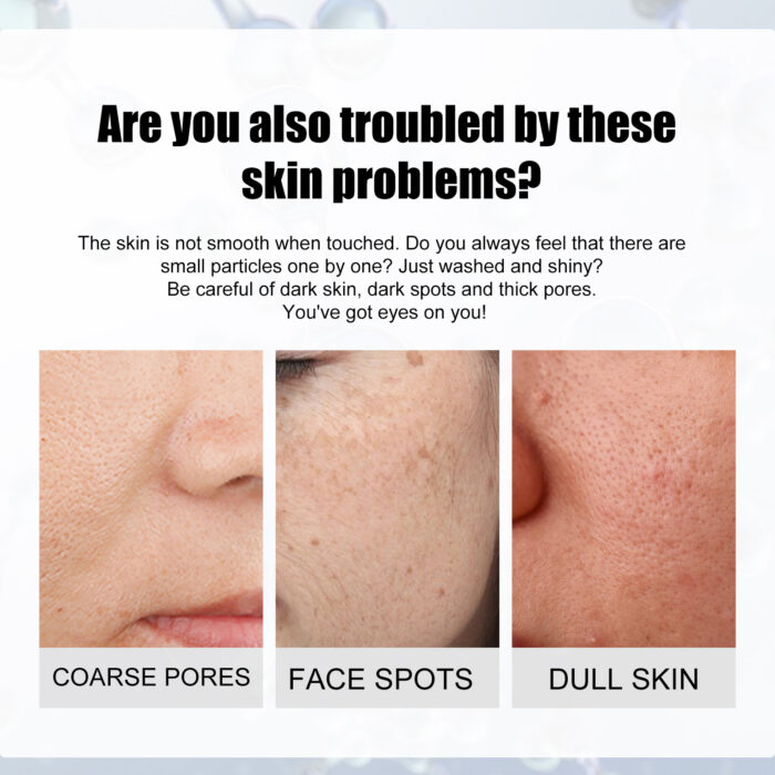 Shrink Pore And Brighten Skin Essence, Moisturize And Lighten Spots Shrink Pores Nicotinamide Original Solution Essence - Image 4