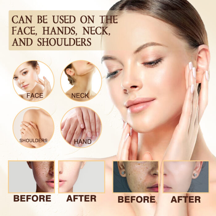 Spot Repair Serum, Lighten Face Spots Repair Dull Skin Hydrating Essence - Image 5