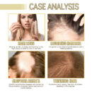 Rosemary Essential Oil For Hair Care, Gentle And Nourishing Hair Care Oil