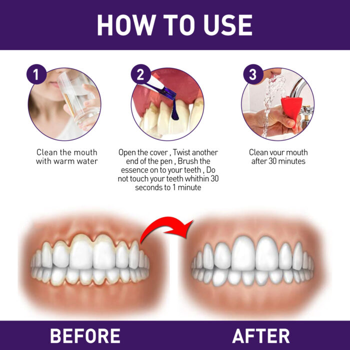 Gum Corrector Pen, Teeth Cleaning Whitening Brightening Repair Gum Teeth Beauty Pen - Image 7