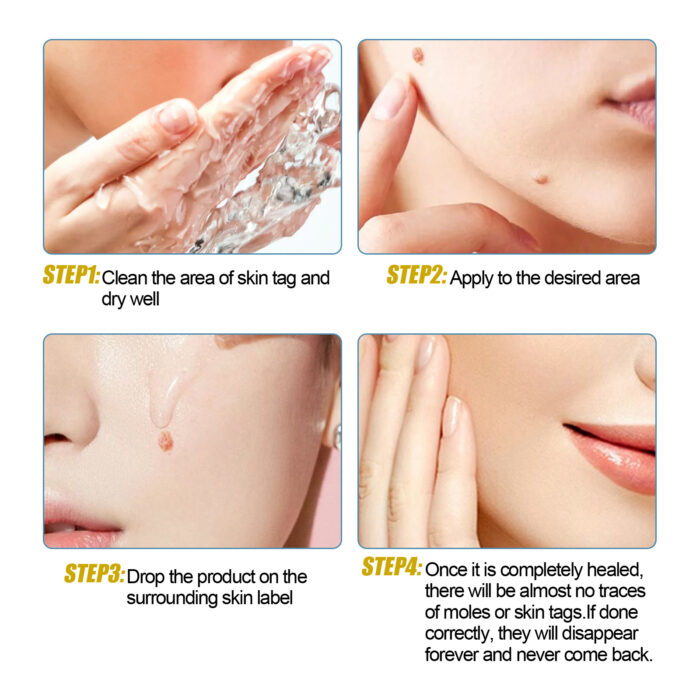 Wart Essence Removes Dark Moles Flesh Moles Repair Skin Neck Flesh Grains Flat Especially Corns Remove Warts - Image 7