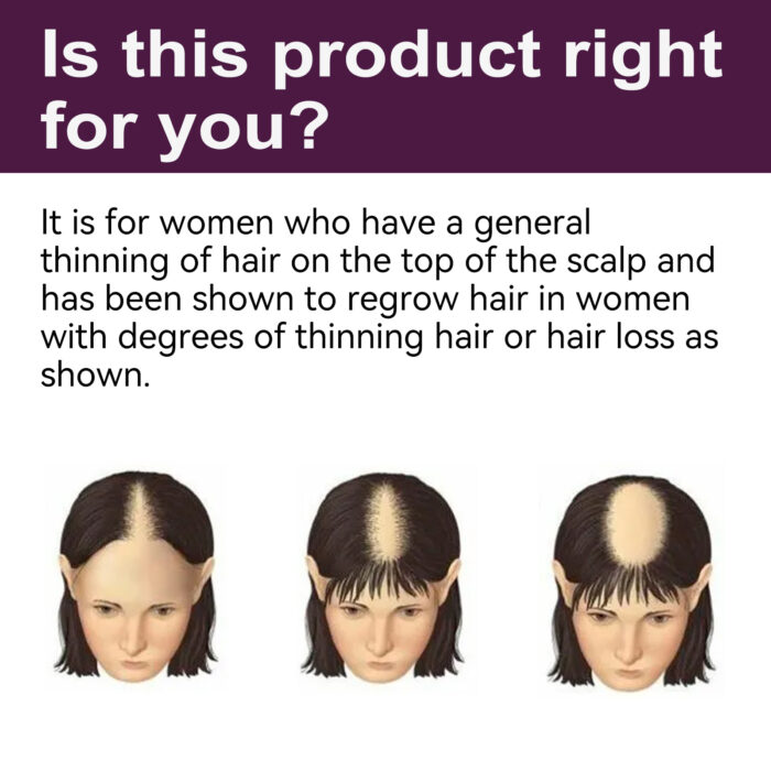 Hair Nutrition Growth Foam, Nutrition Strengthens Hair, Prevents Hair Loss And Irritates Hair Follicles - Image 4