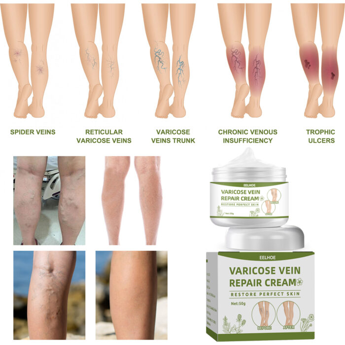 Leg Repair Cream Relieves Leg Discomfort Massage Leg Repair Cream For Raised Veins - Image 4