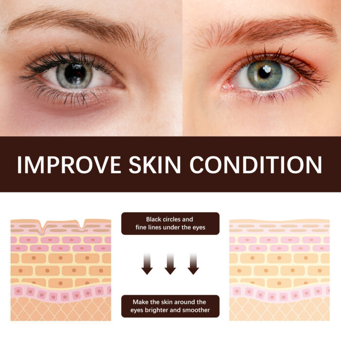 Retinol Eye Cream Firming, Moisturizing, Lifting And Smoothing Fine Lines Crow's Feet Anti-wrinkle Eye Cream - Image 5