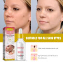 Wart Essence Removes Dark Moles Flesh Moles Repair Skin Neck Flesh Grains Flat Especially Corns Remove Warts