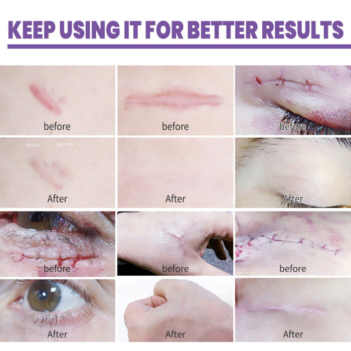 Skin Care Cream, Daily Moisturizing, Smoothing And Firming Skin Repair Postpartum Repair Topical Cream - Image 5
