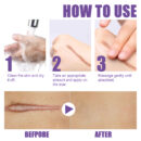 Skin Care Cream, Daily Moisturizing, Smoothing And Firming Skin Repair Postpartum Repair Topical Cream