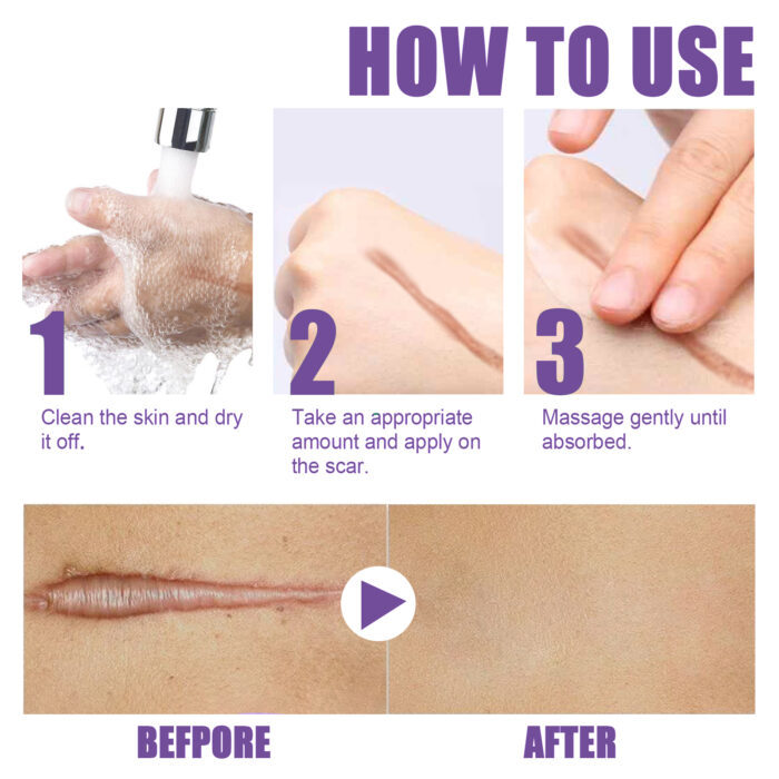 Skin Care Cream, Daily Moisturizing, Smoothing And Firming Skin Repair Postpartum Repair Topical Cream - Image 7