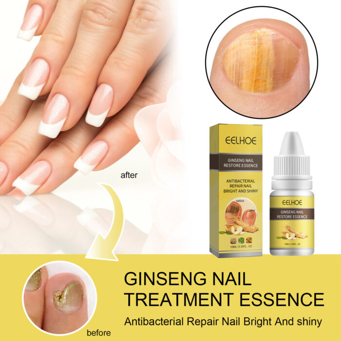 Ginseng Nail Essential Oil Grey Nail Thickening Nail Repair Brightening Nail Removing Soft Nail Moisturizing Essence - Image 3