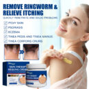 Skin Care Cream Gentle Ingredients Nourish Body Skin And Relieve Redness Skin Care Cream